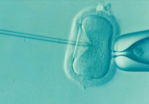 In-vitro fertilization (IVF)