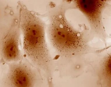 Quantitative Phase Imaging for Cytology