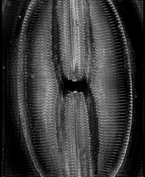 Label-free-tissue-imaging__Appli-Diatom-GIFveiw