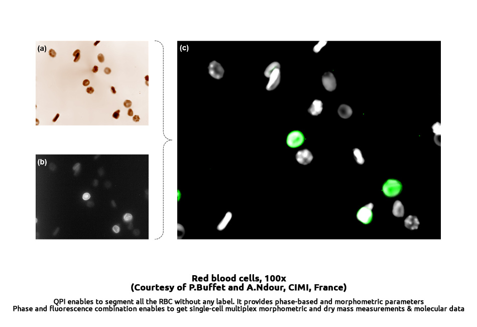blood_testing-redbloodcells2