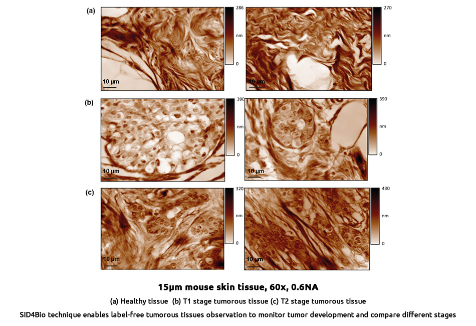 label-free-tissue-imaging-cancer-biology