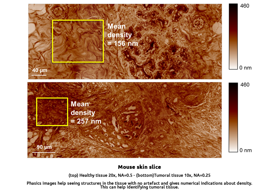 label-free-tissue-imaging-tumoral-tissue-density