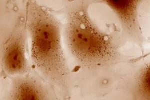 Quantitative Phase Imaging for Cytology